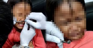 Aduh dik, macam mana kepala zip boleh 'sangkut' dalam hidung? | Harian Metro