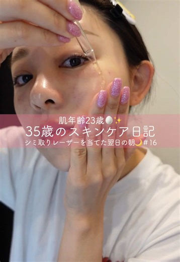 35歳のスキンケア日記: シミ取りレーザー体験