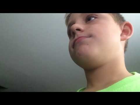 How to fix a amazon fire TV stick if network connection is lost