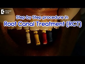 What are the step by step procedures in an RCT? - Dr. Arundati Krishnaraj