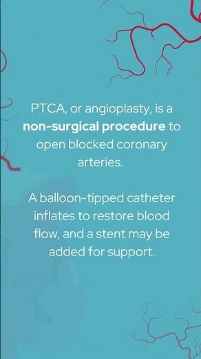 What is PTCA (Angioplasty) and Why is it Performed?