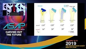 What Is the Best Humeral Neck-Shaft Angle?