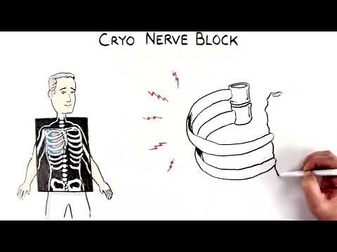 Cryo Nerve Block Patient Animation