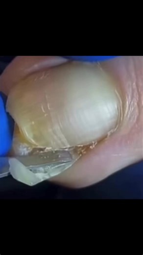 Tip ✅Keeping your cuticles in good health👉🏻use a cuticle stick or an orange stick to gently push them up and out of the way of the nailbed. Don’t cut your cuticles as they can bleed and become infected. Their purpose is to protect new nail growth from bugs and bacteria, so we need them! #fbviralpost2025シ #satisfyingvideo #ingrowntoenail #pedicure #nails #instragram | Elenita Onitnelot