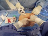 'Fail-Safe' First Abdominal Entry for Laparoscopic/Robotic Surgery ("Streaming Hollow-Entry") • Video • MEDtube.net