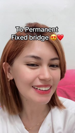 Temporary vs Permanent Fixed Bridge: Pros and Cons