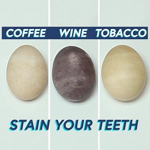 1.5K views | "...Great for removing coffee stains and my teeth feel clean... This product could not be any easier to use. Awesome gel whitening process. All smiles!" Save 50% when you order today plus FREE SHIPPING! | smileactives | Facebook