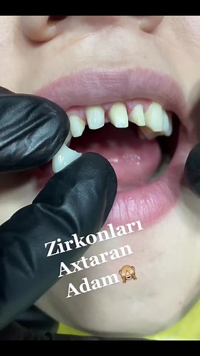 Dental Exam Process: Close Up on Teeth and Gums