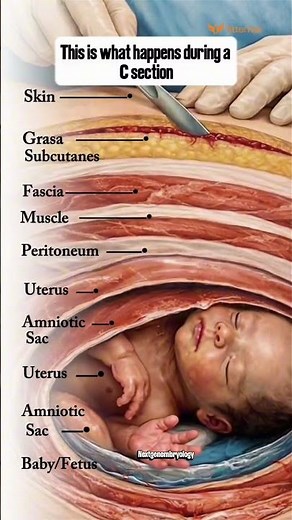 What Really Happens During a C-Section? | 7 Layers Explained 😳 #shorts #Healthcare #MedTok #baby