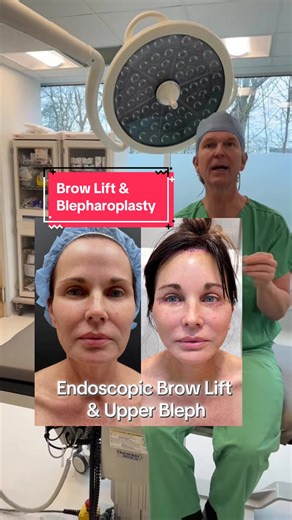 Understanding Brow Lifts: Key Differences Explained