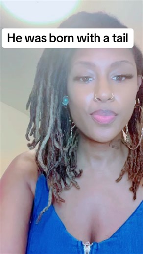 Man Born with Tail: Shocking Birthday Revelations