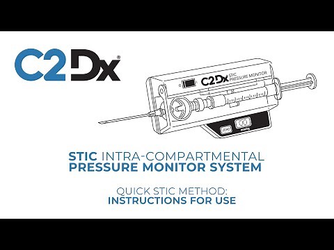 Measure Compartment Pressure - STIC (Quick Method) Instructions