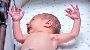 Was ist der Moro-Reflex? Was wenn er nicht weg geht?