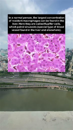 What are Kupffer cells? #liver #macrophages #immunesystem #medicine #anatomy