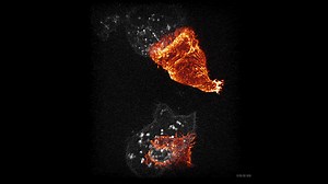 Mito Warriors: New Footage Shows T Cell Assassins Hunting Down and Destroying Cancer Cells