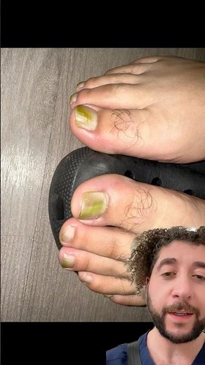 Green Toenails? Not Polish… It’s a Pseudomonas Infection 👀🦠