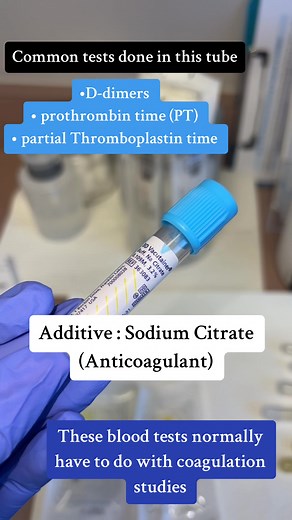 Replying to @Corie with an IE Heres a more detailed video 🙏 #blooddraws #bloodtubes #phlebotomy101 #blooddraw #drawingblood #phlebotomist #nursetok #medicaltok #phlebotomytips #coffeescrubsandrubbergloves #scrubs #lab #labtech #medicalassistant #phlebotomistlife #fyp #foryourpage #medicaloffice #healthcare #nursingstudent #nursesoftiktok