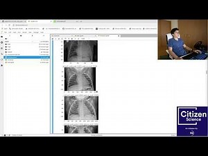 Chest X-ray scan classifier for covid-19 using pytorch