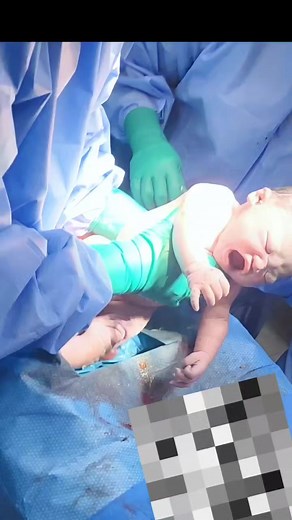 5.6K views · 82 reactions | Birth is beautiful! So much happens in those first moments. #obgynlife #pregnancyjourney | Snippets of OBGYN Life | Facebook