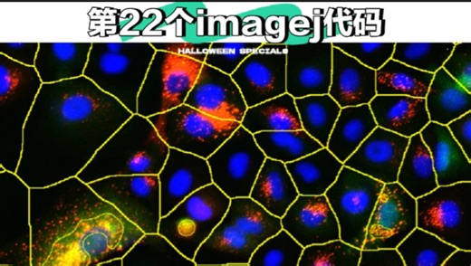Imagej自动批量处理细胞质共定位代码