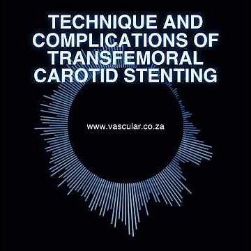 MET - 26 - Technique and Complications of Transfemoral Carotid Stenting