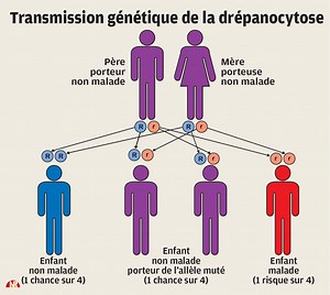 Drépanocytose : un espoir thérapeutique