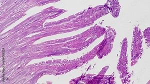 Human large intestine in section magnified under microscope in 100 times filmed on bright field background. Tissue of digestive system organ studied in medical lab during check. Anatomy research