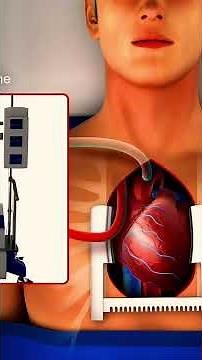 How Doctors Perform Open Heart Surgery | Full Explanation