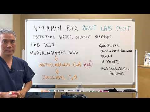 Vitamin B12---Best Lab Test