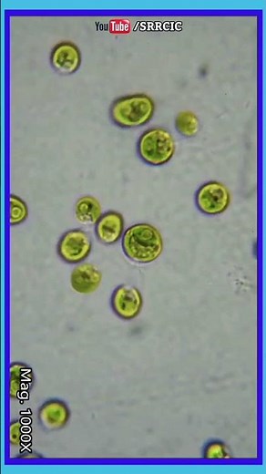 Biology - Algae/शैवाल - Chlamydomonas Under Microscope. #chlamydomonas #algae