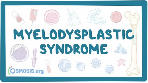 Myelodysplastic syndromes: Video, Causes, & Meaning | Osmosis
