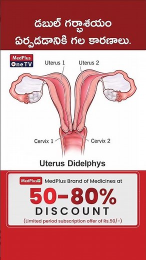 Double uterus - Symptoms and causes l Dr. B Radhika #shorts ‪@MedPlusONETV‬