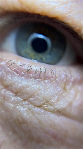 7K views · 54 reactions |  Fixational Eye Movements, Concussion &...