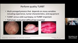 Optimizing Bladder Cancer Treatment During the BCG Shortage Era