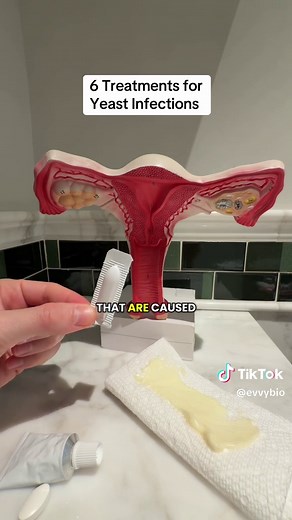 6 Treatments for Yeast Infections