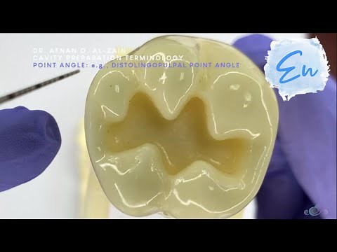 Cavity Preparation Terminology – cavity walls, line angles & point angles in Operative - En