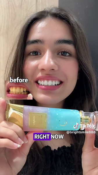 Transform Your Smile with Niacinamide Whitening Toothpaste