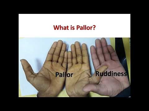 What is Pallor in Medicine || Where to Look for Pallor