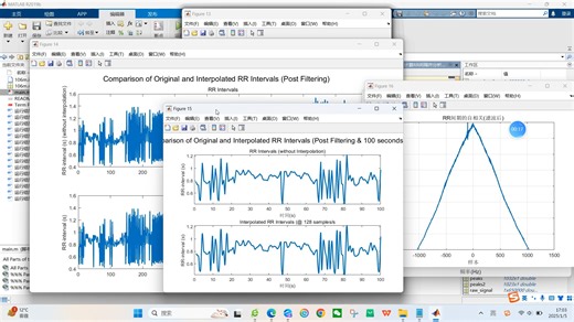 【心电信号ECG】基于matlab ECG心电信号心率变异性（处理原始数据、识别心跳、计算RR间隔并分析）【含Matlab源码 10921期】