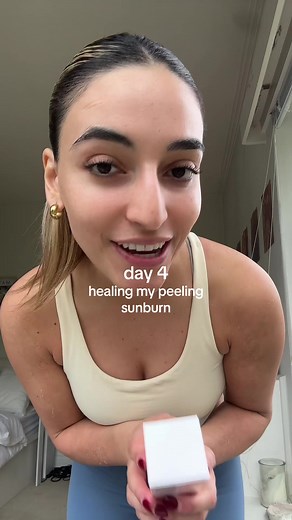 Healing Peeling Sunburn with Bio Oil - Skin Care Tips