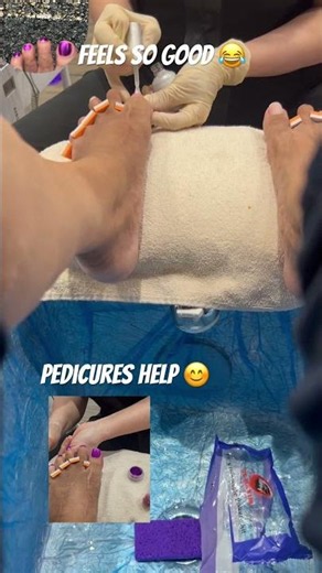 Purple Chrome Nails & Foot Recovery Update 💜👣#foot #swollenfeet #pedicure #senior