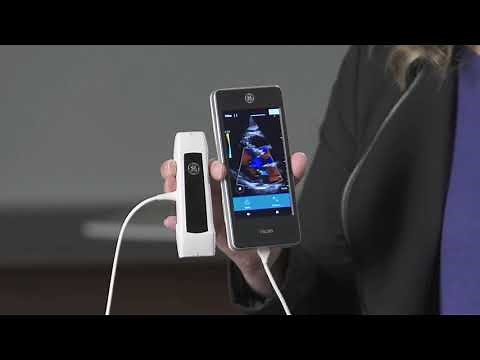 GE Vscan Extend Ultrasound - General Overview