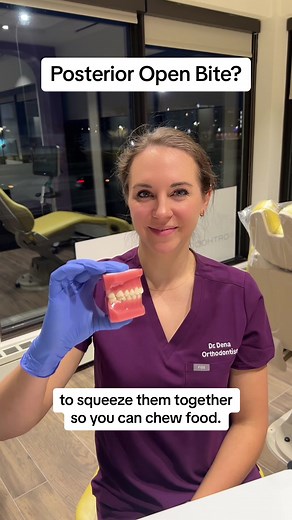 Fixing Posterior Open Bites: Dental Solutions
