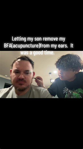 Share and follow…. Letting my son remove my BFA from my ears. It was a good time. #acupuncture #dadsoftiktok #creatorsearchinsights #dsd #battlefield