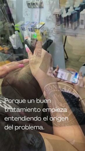 Tratamiento nioxin