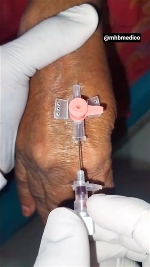 IV Cannula Insertion 20G 💉 | Step by Step IV Injection Technique for Beginners #shorts #trending