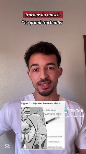 Injection intramusculaire #ispits #infirmiere #aidesoignante #ifps #nurse #doctor #injection #tiktoknews