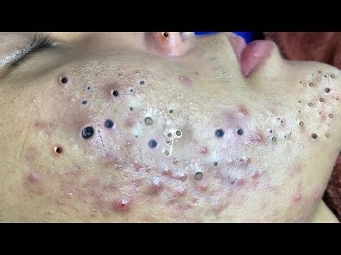 𝐒𝐚𝐭𝐢𝐬𝐟𝐲𝐢𝐧𝐠 𝐑𝐞𝐥𝐚𝐱𝐢𝐧𝐠 𝐖𝐢𝐭𝐡 𝐋𝐍𝐆 𝐒𝐩𝐚 #𝟓𝟎𝟎𝟏