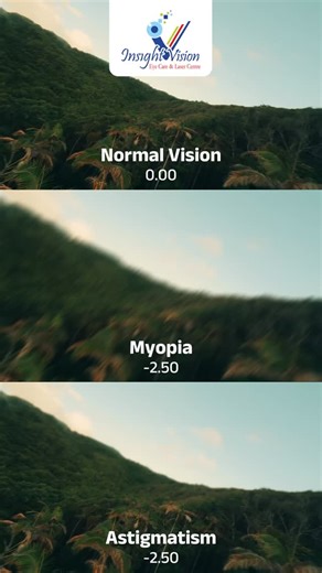 Seeing clearly at all distances is what we call normal vision. but when faraway objects blur, it’s often myopia.and when vision looks stretched or shadowed, that’s astigmatism. every eye sees the world a little differently. 👁️ 📞 Call us now & schedule an appointment. Phone: 098339 95055 Website: https://insightvision.in/ Address: https://share.google/YOxSCTdIZ1EfRMRQt #insightEyecareandlaser #festivecelebration #teamtogether #clearvisionahead #normalvision | Insight Vision Eye Care & Laser Cen