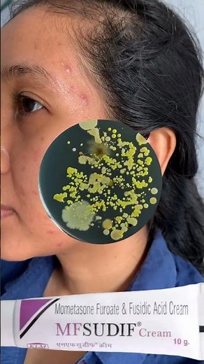 MFSUDIF Cream uses in Hindi and mechanism of action, infected skin treatment